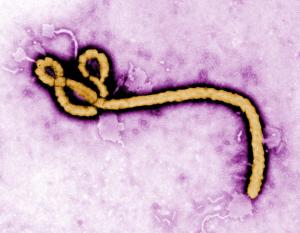 The Ebola virus, though similar in shape to a famous childhood character, is in no way affiliated with Mickey Mouse.